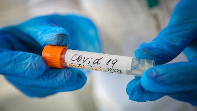 Ново рязко увеличение на новозаразените с COVID 19 бе регистрирано в