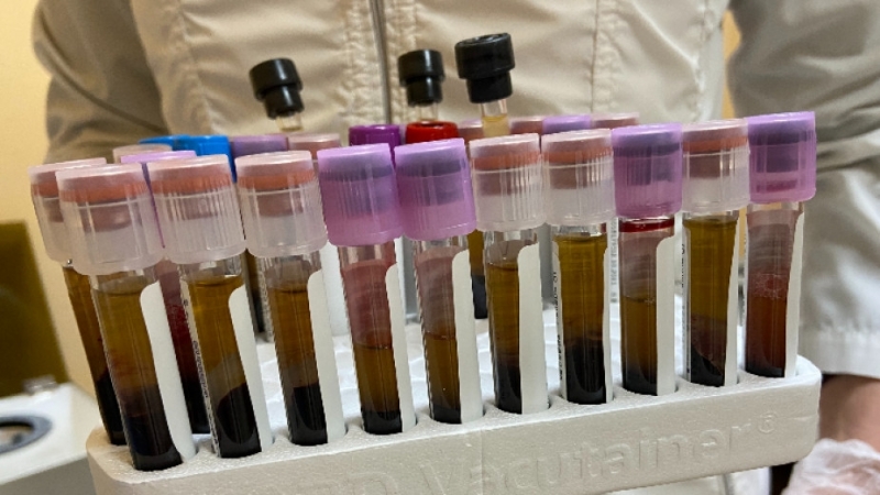 866 са новите случаи на коронавирус в България за изминалото