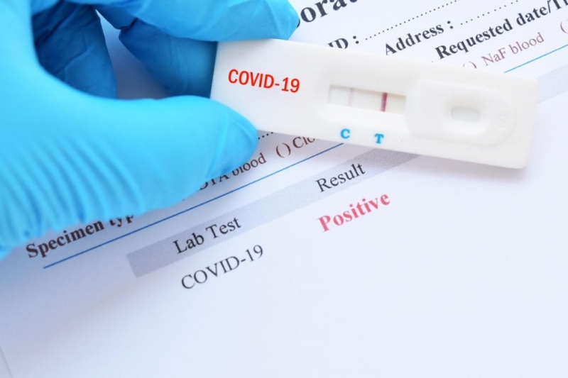 175 са новоустановените случаи на COVID-19 на територията на област