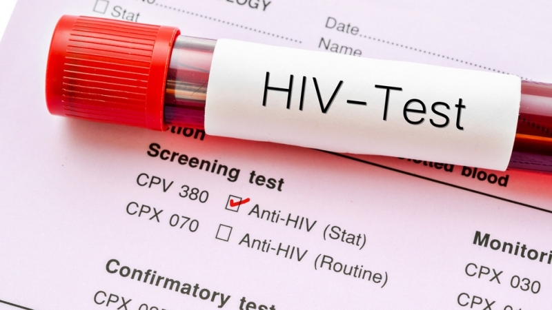 Откриха лекарство срещу СПИН Многонационален екип от учени твърди че