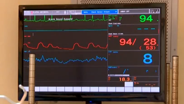 Безплатни прегледи ще се предлагат на болните от хронично обструктивна