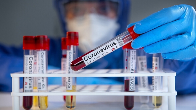 1188 са потвърдените случаи на COVID 19 у нас по данни