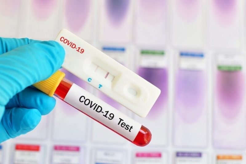 133 са новите случаи на COVID 19 у нас за последното