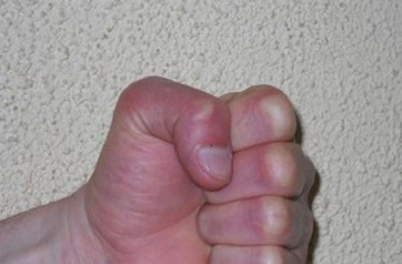 За причиняване на телесна повреда на наемен работник Районния съд