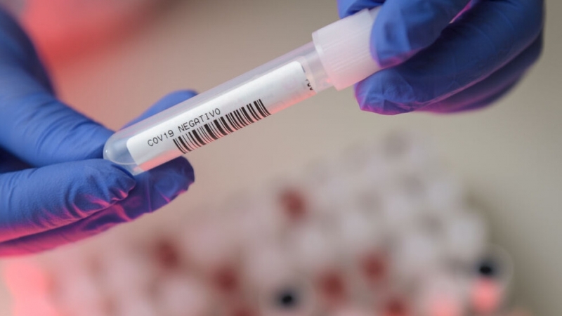 Словакия започна да тества за коронавирус почти цялото си население