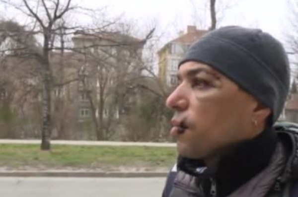 Велосипедист пострада сериозно при инцидент с автобус в центъра на