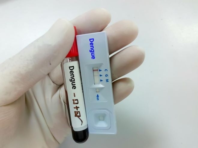 Световната здравна организация СЗО съобщи вчера че регистрираните случаи на