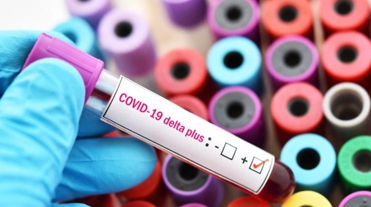 Вариантът Делта плюс на COVID 19 вече е в България става