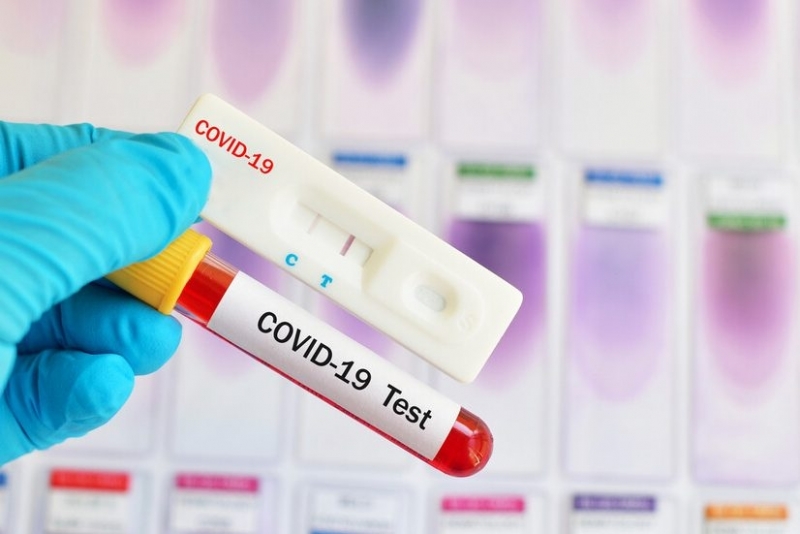 Новите случаи с коронавирус за изминалото денонощие у нас са