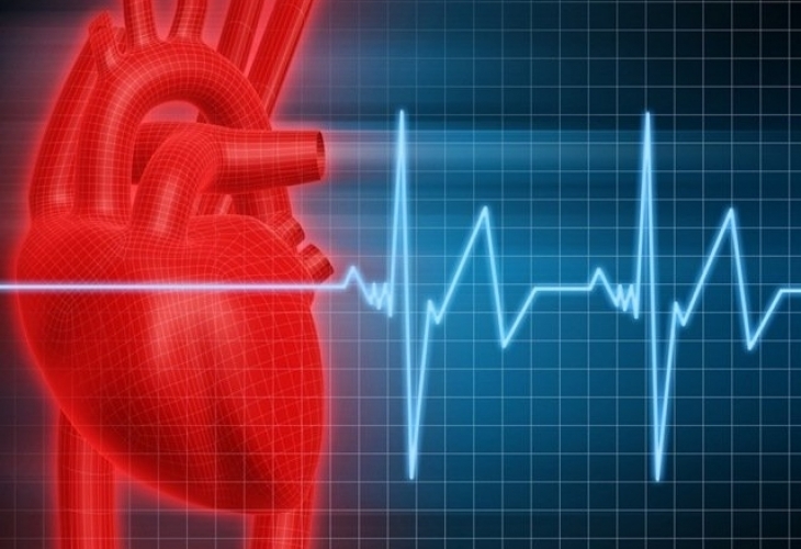 Аритмията представлява неритмична сърдечна дейност - сърцето може да бие