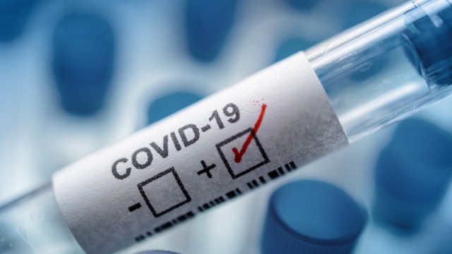 Чехия регистрира рекордните 118 нови случая на COVID 19 в четвъртък
