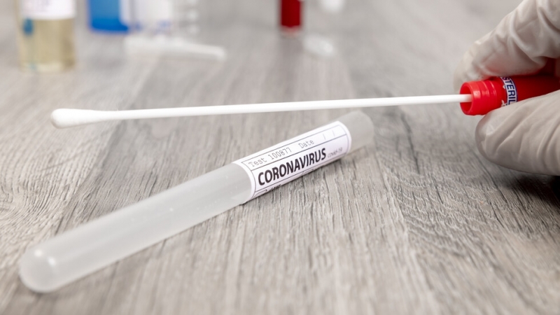 Във Великобритания всекидневни бързи тестове за COVID 19 може да се