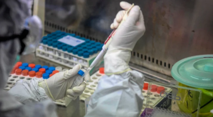 Френският нобелов лауреат и откривател на СПИН Люк Монтание заяви