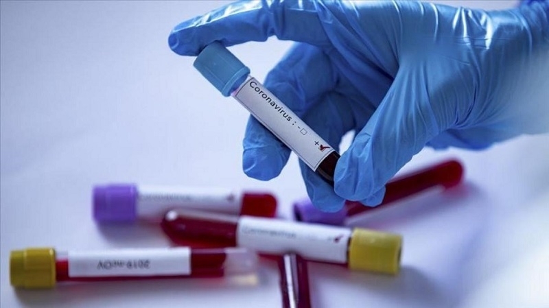 5 нови проби за коронавирус са взети за изминалото денонощие