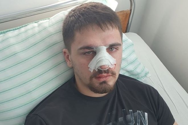 Баща от Плевен сигнализира в социалните мрежи: Полицаи смляха от бой ...