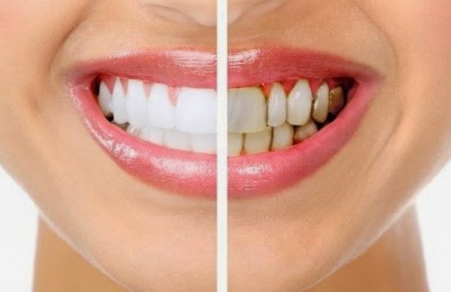 Устната хигиена оказва влияние върху цялостното ни здравословно състояние затова