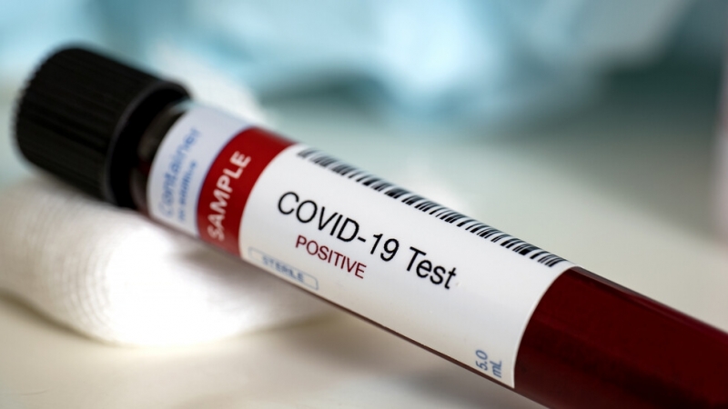 14 са новите случаи на коронавирус у нас Това съобщи