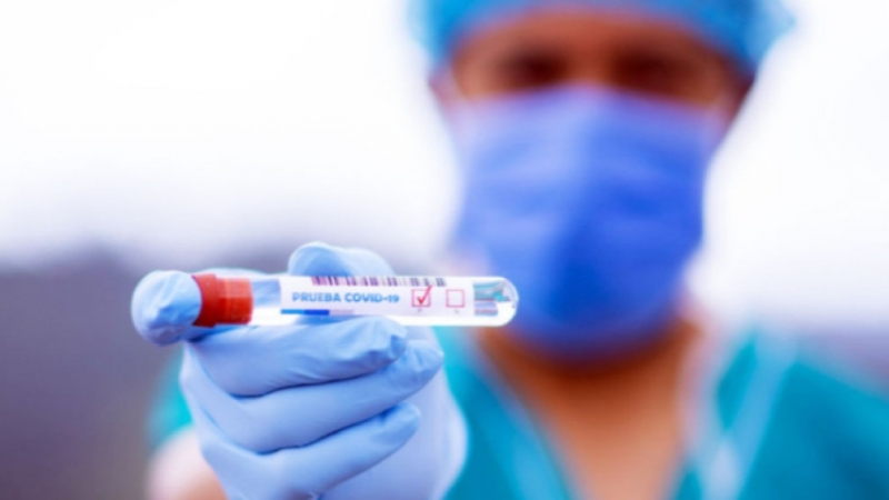 1998 са новодиагностицираните с COVID 19 лица у нас за изминалите