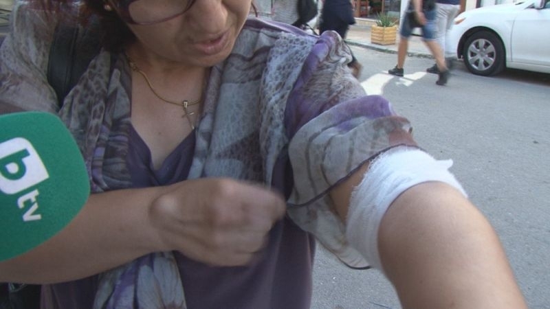 Ротвайлер е нападнал и нахапал жена в центъра на Бургас