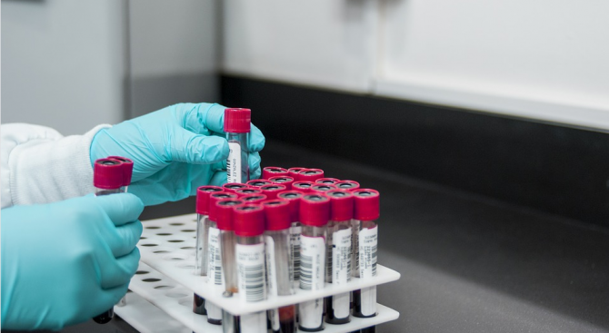 240 нови случая на заразени с вируса на СПИН са