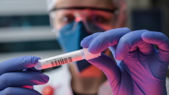 Медицински работник в производствено предприятие в Ямбол е с положителна