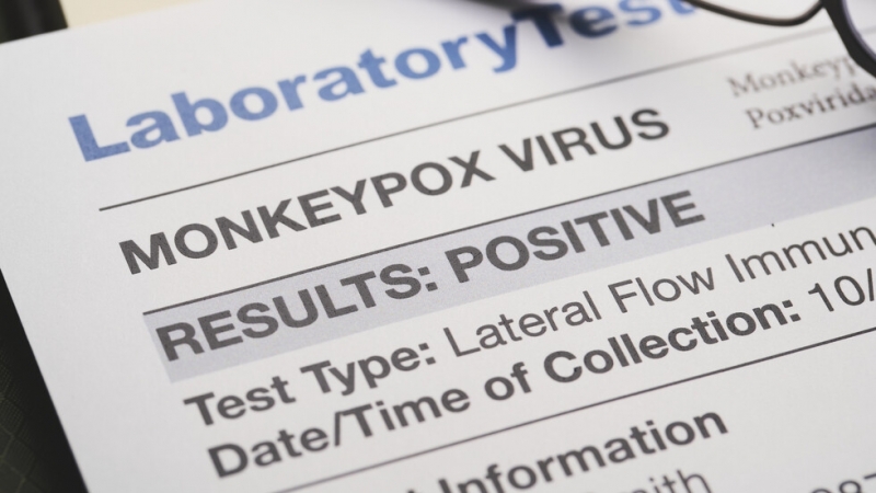 ЕС иска ваксинационни стратегии за маймунската шарка, СЗО обмисля ограничения за пътуване