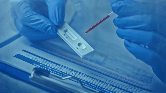 Хората попадащи в рискови групи като възрастните страдащите от хронични