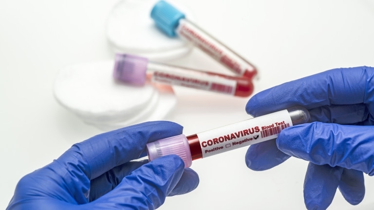 Новата заразена с коронавирус от Врачанско е 55 годишна жена става