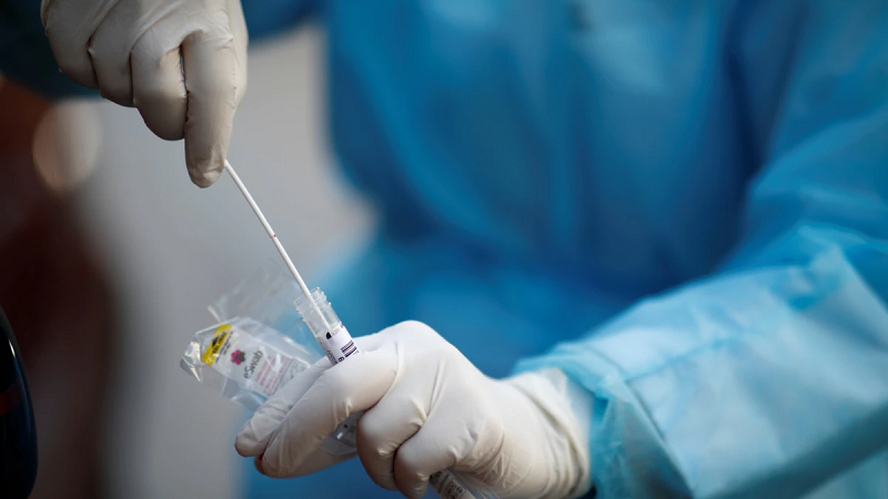 3625 са новодиагностицираните с COVID 19 лица у нас за изминалите 24