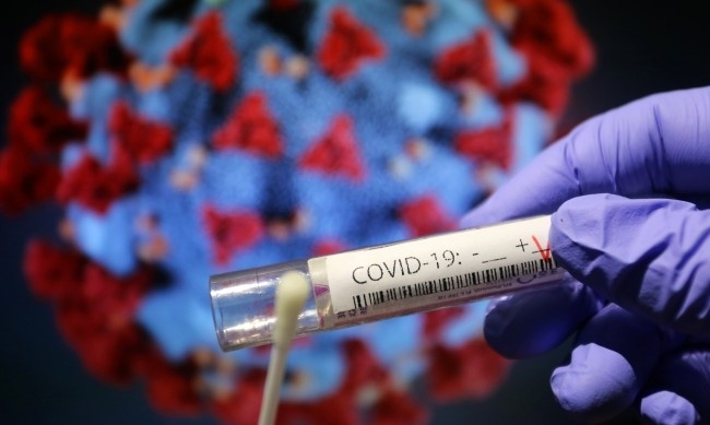 1904 са новодиагностицираните с COVID 19 лица у нас за изминалите