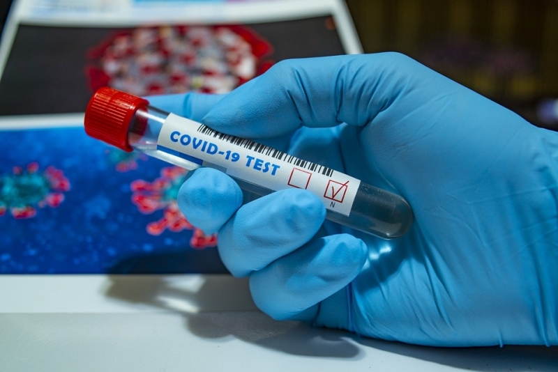 Нови 8 души от Видинско са положителни проби за коронавирус,