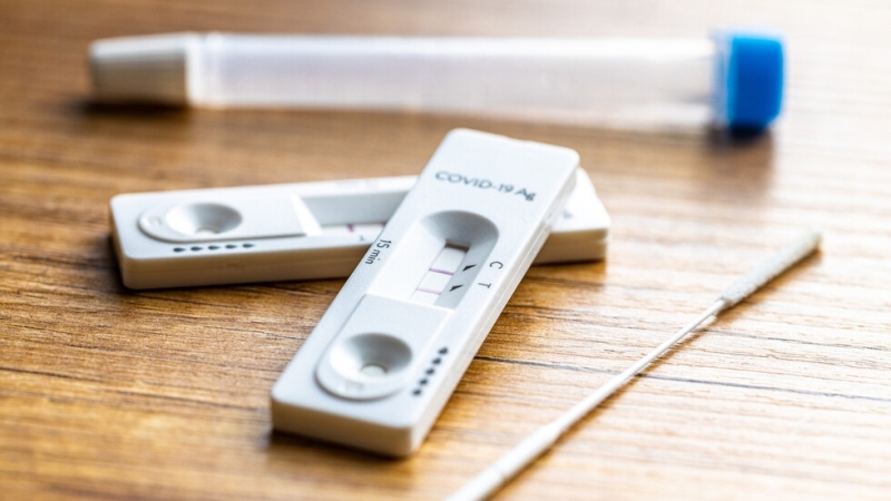 206 са новите случаи на COVID 19 у нас за последното