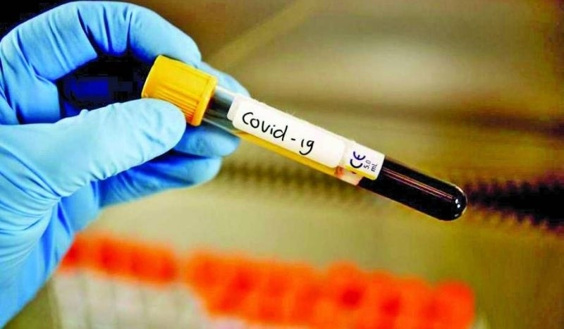 552 са новите положителни случаи на COVID 19 у нас за