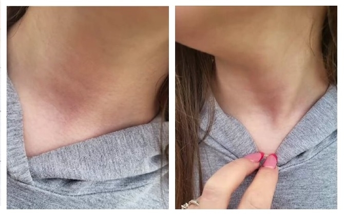 Майка на 11 годишно момиче твърди че дъщеря ѝ е нападната