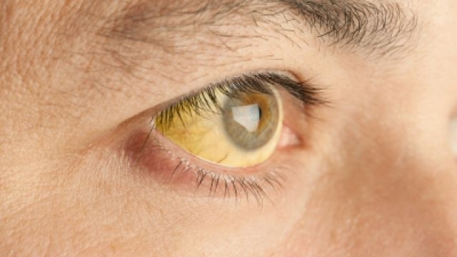 Няколко заразни болести повалят врачани сочат данните на регионалната здравна