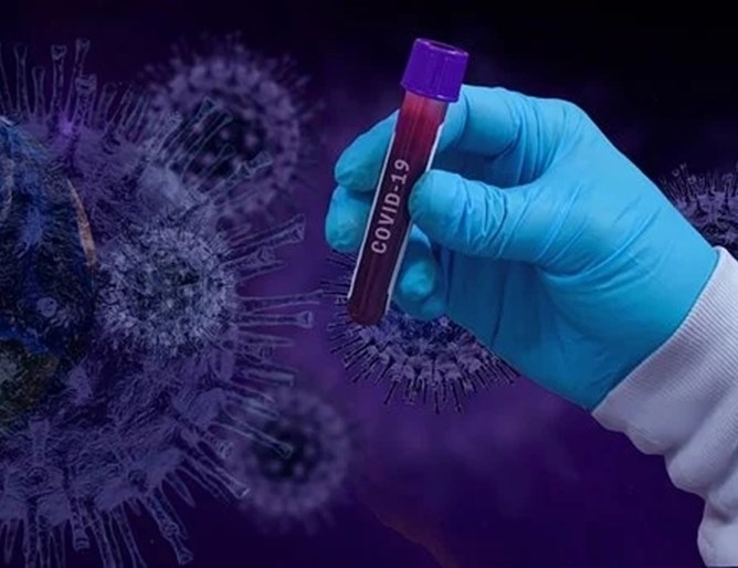 Предизвиканата от новия коронавирус пандемия е причинила смъртта на над