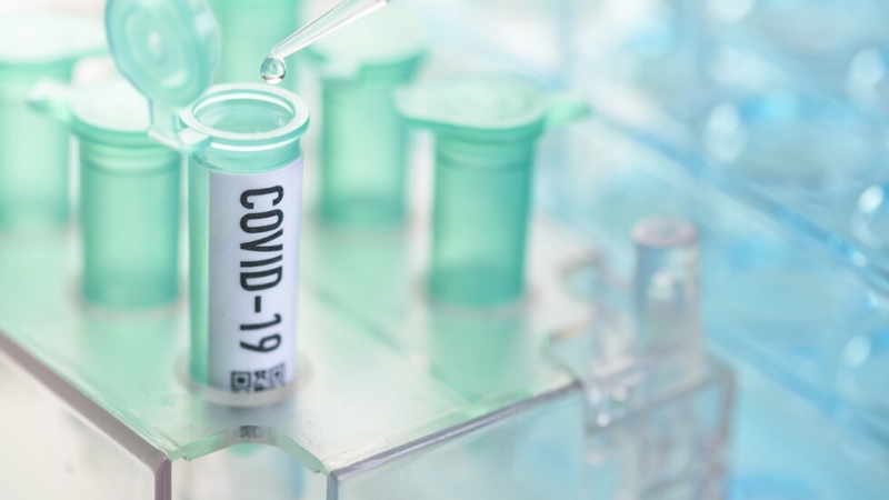 180 са новите положителни проби за COVID 19 при направени 2 591