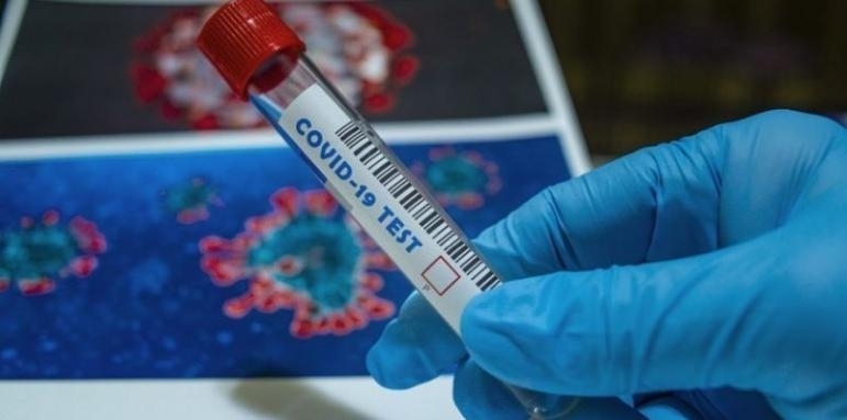 293 новозаразени с коронавирус, 17 са в Северозапада
