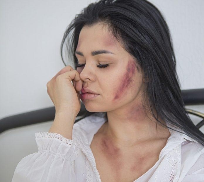 Мъж преби приятелката си в Плевенско съобщиха от полицията На 8 януари е