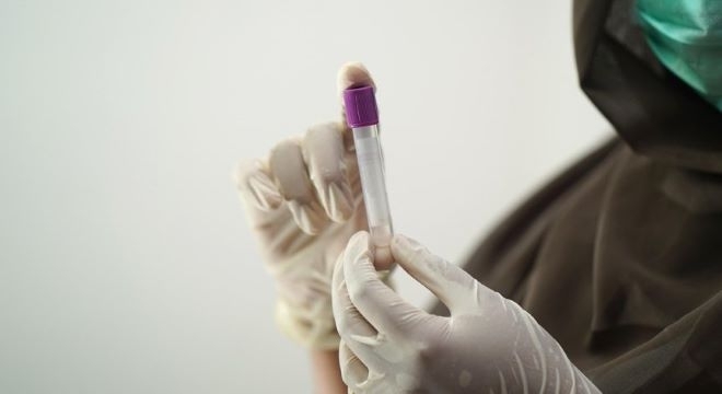 Миналата седмица в България беше регистриран първи потвърден случай на