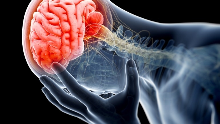 Мозъчният удар е едно от най тежките страдания защото често е