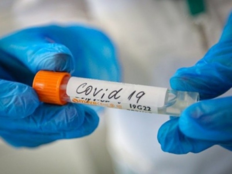 254 са новозаразените с коронавирус което е с 66 случая