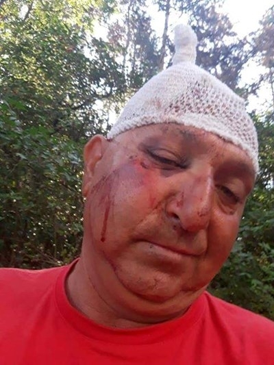 Баща и син от гърменското село Дъбница нападнали съседите си и