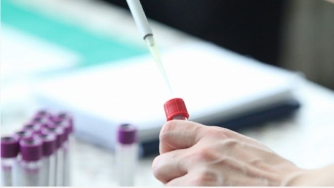 Тринадесет нови случая на COVID 19 са регистрирани за последните 24 часа починали