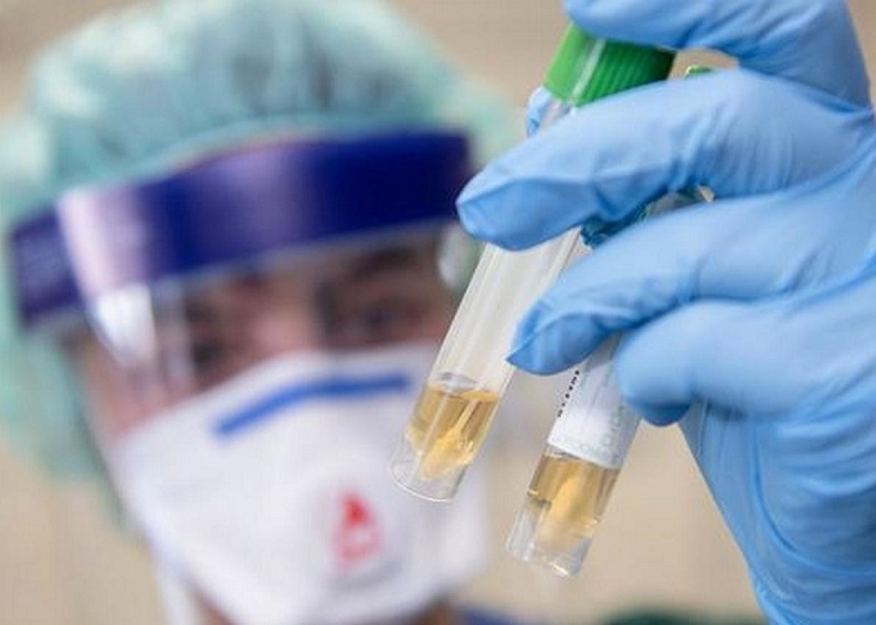 1640 са новодиагностицираните с COVID 19 лица у нас за изминалите