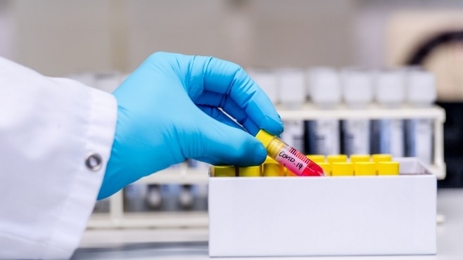 Започнало е масово тестване на персонала в специализираните институции за