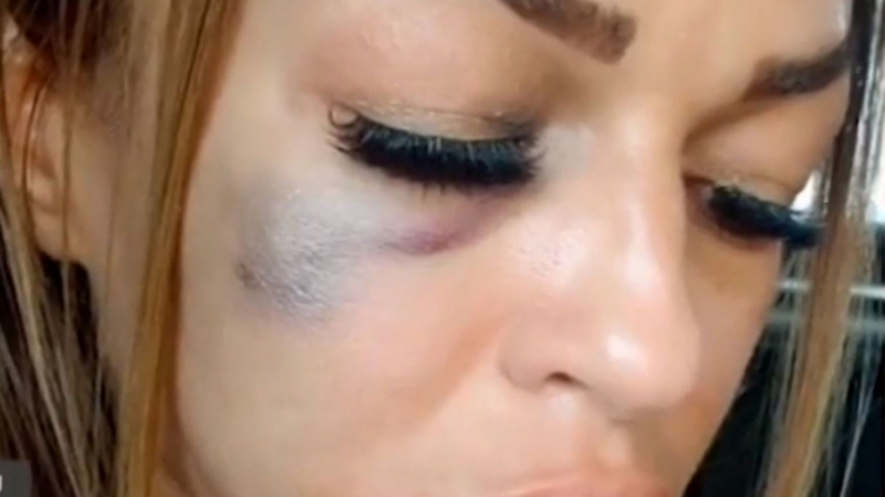 50 годишен мъж преби съпругата си в село Браничево община Каолиново съобщиха от