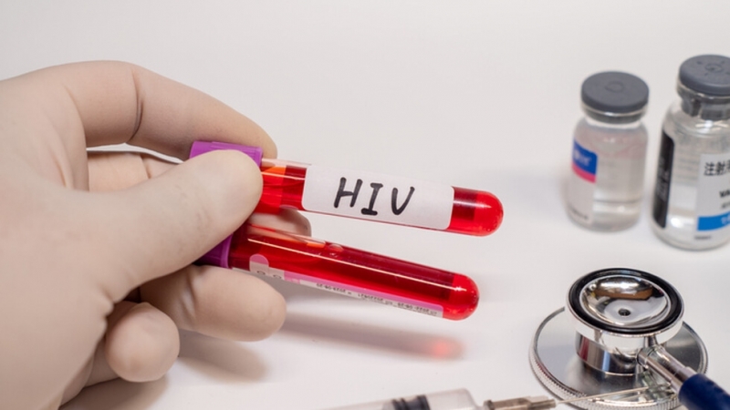Три жени са диагностицирани с ХИВ след като се подложили