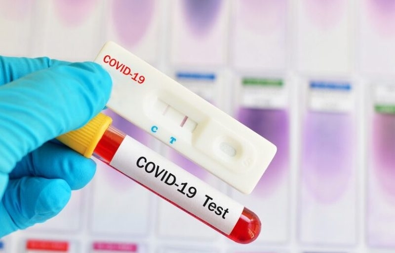 Новите потвърдени случаи на коронавирус у нас за последното денонощие