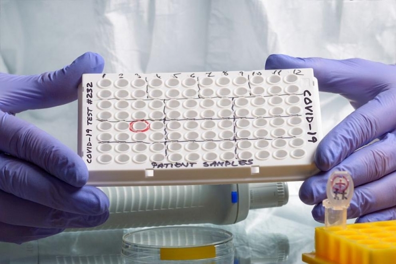 Лабораториите в Монтана отчитат наплив от желаещи да се тестват